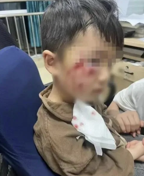 被瘋?cè)麤]有“救命藥”，怎么辦？